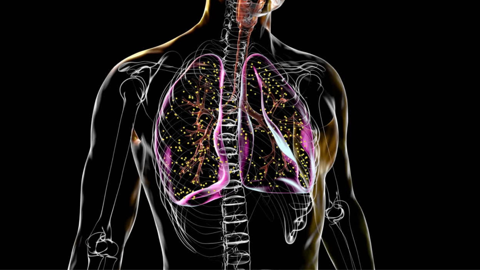 Tuberculose au Gabon : une menace silencieuse qui appelle une riposte renforcée